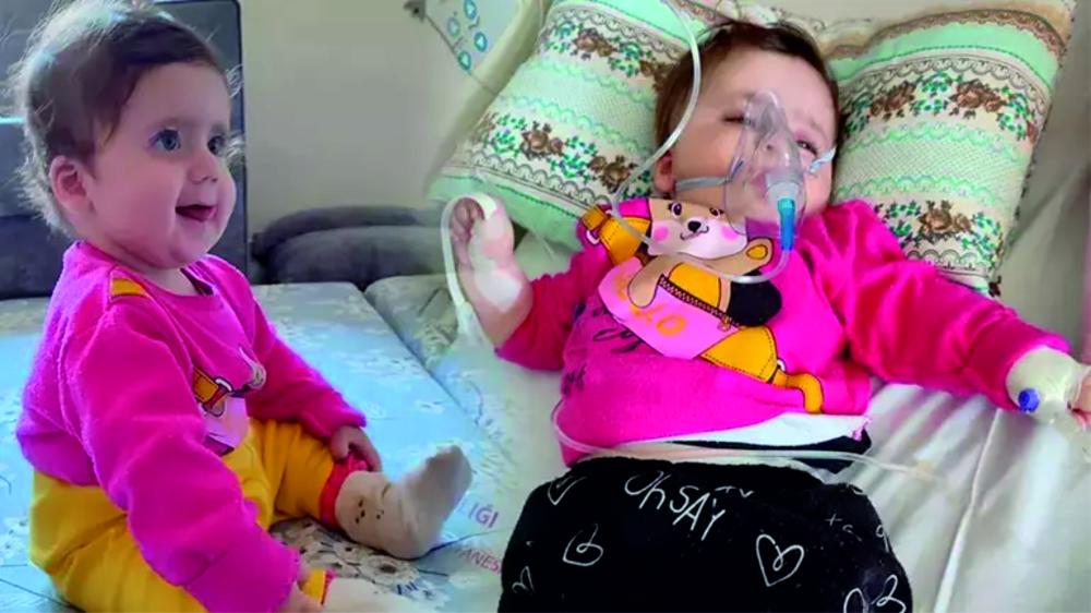 SMA TİP 1 HASTASI İKRANUR Zamanla Yarışan Bir Ailenin Çığlığı